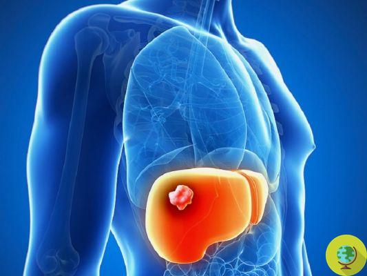 Triclosan pode causar danos graves ao fígado, incluindo câncer