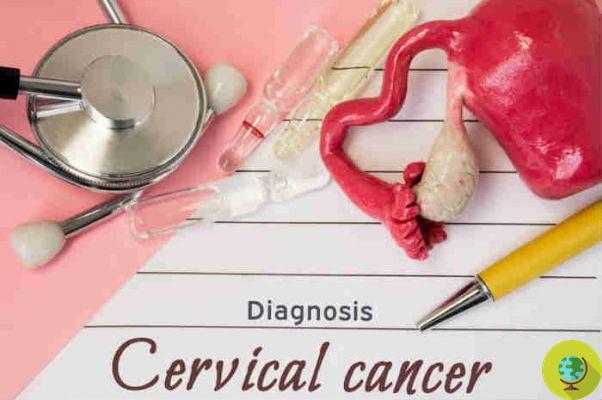 Cervical cancer: the vinegar test that saves women