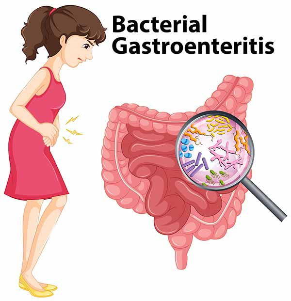 Gastroenteritis: causes, symptoms and remedies in children and adults
