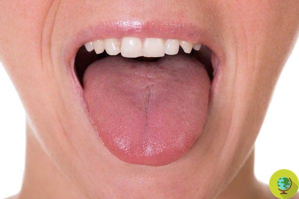 Vitamin B12: if your tongue has this shape it could be a sign of a deficiency