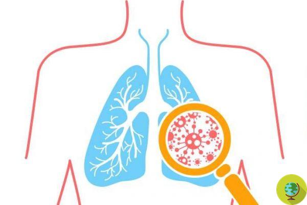 Pneumonia: the 15 symptoms not to be underestimated