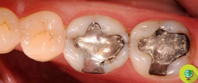 Mercurio en odontología: el veneno en nuestros dientes (PETICIÓN)