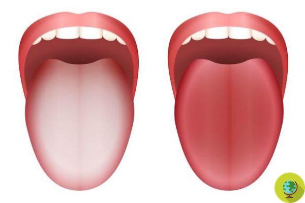 Si tu lengua es de este color inusual, puede ser una señal de que NO debes subestimarla.