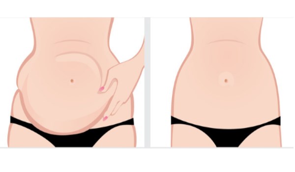 What kind of belly do you have and the most effective ways to permanently reduce it