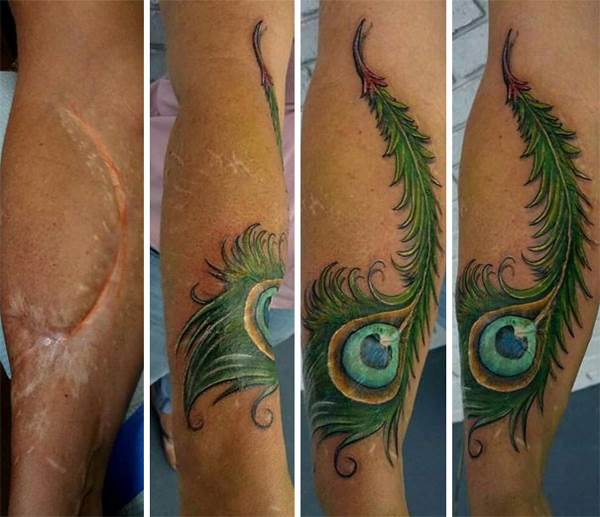 Increíbles tatuajes que convierten las cicatrices en obras de arte