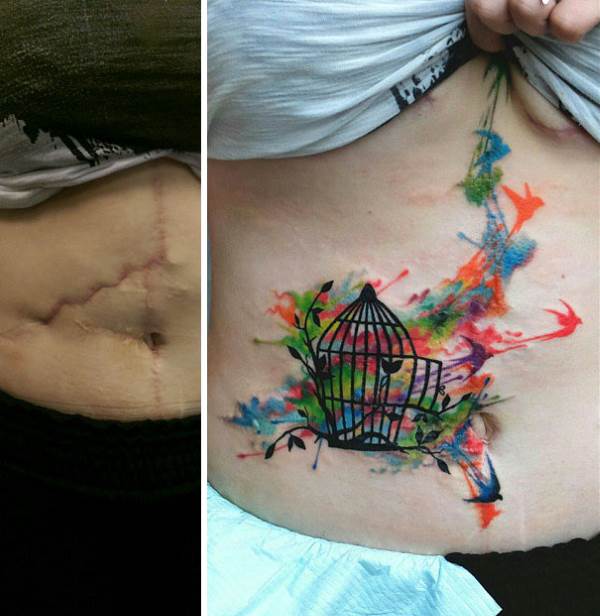 Amazing tattoos that turn scars into works of art