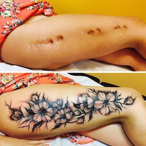Tatuagens incríveis que transformam cicatrizes em obras de arte