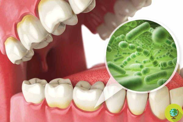 Teeth: how sugary, high-glycemic foods destroy the oral microbiome of women over 50
