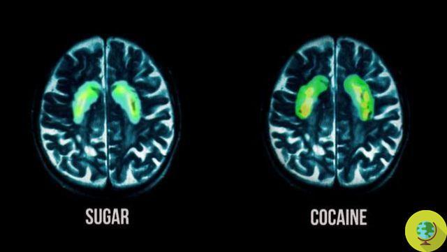 ¿Qué le sucede al cerebro cuando dejamos el azúcar blanco?