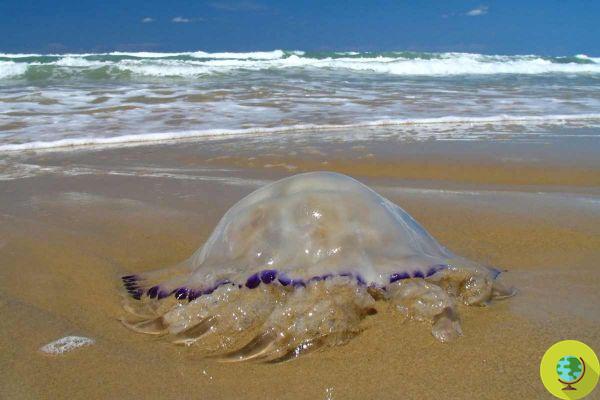Jellyfish: 10 natural remedies and what to do in case of a sting