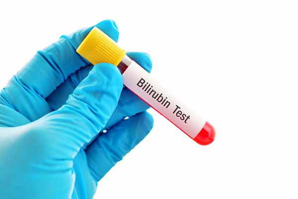 Bilirubin: what it is, reference values ​​and when to worry