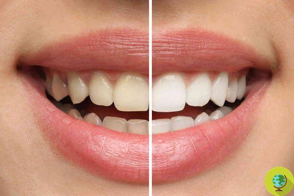 Pode parecer absurdo, mas você pode clarear os dentes com cacau desta maneira deliciosa aprovada por dentistas
