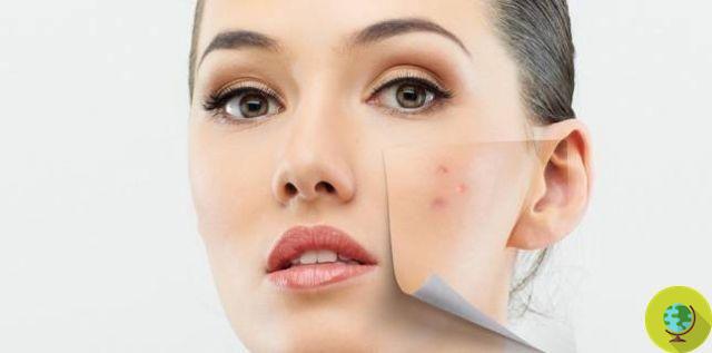 Manchas en la piel: 10 trucos y remedios naturales