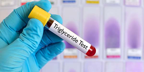 Low triglycerides: causes, symptoms and treatments