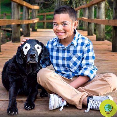 Carter learned to love his skin thanks to this dog who has the same disease