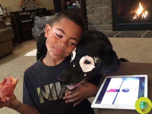 Carter aprendió a amar su piel gracias a este perro que tiene la misma enfermedad