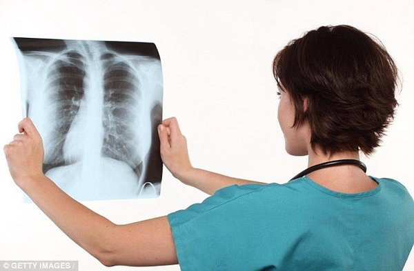 Les détergents contiennent des substances nocives pour les poumons, confirme une nouvelle étude