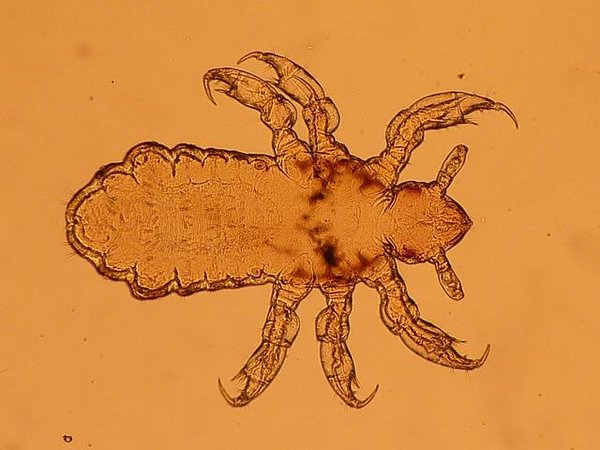 Lice resistant to treatments like bacteria: super lice are on their way