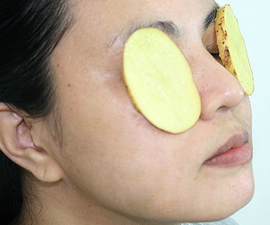 Treating headaches with potatoes