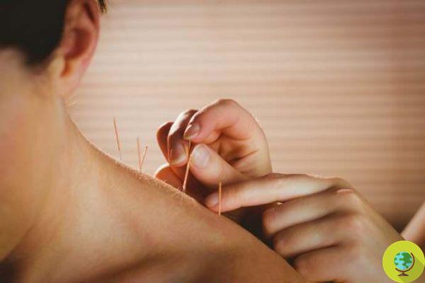 L'acupuncture mieux que les hormones contre les symptômes de la ménopause. La confirmation de la science