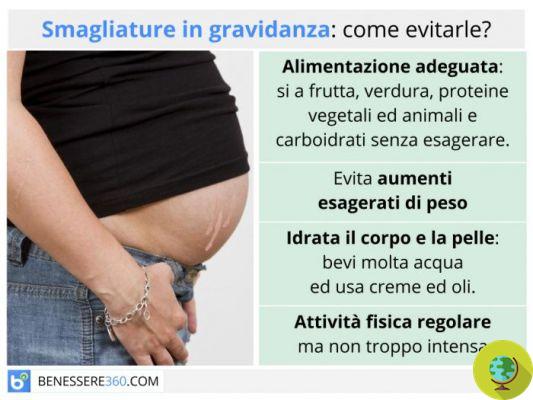 Embarazo: consejos y remedios naturales para evitar las estrías