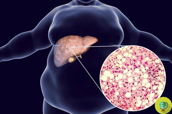 If you notice these signs you may have liver problems that should not be underestimated