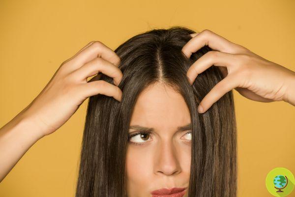 Cheveux gras : 8 remèdes naturels