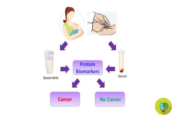 Breast cancer: biomarkers for early diagnosis identified for the first time thanks to breast milk