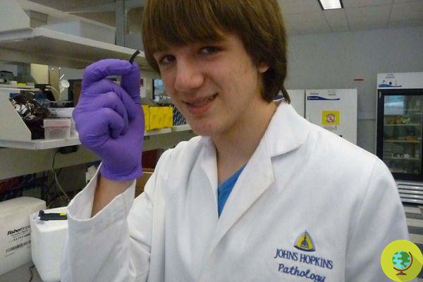 This 15-year-old boy has devised a test to diagnose pancreatic cancer early