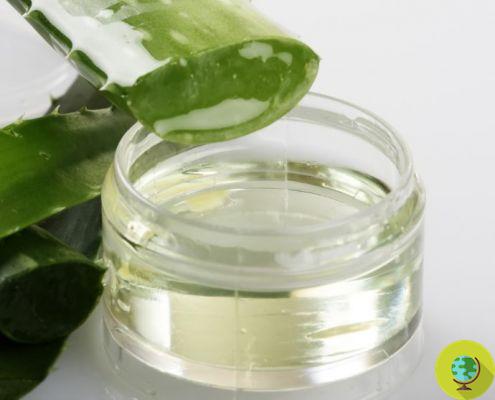 Aloe Vera: how to extract the gel and 10 ways to use it