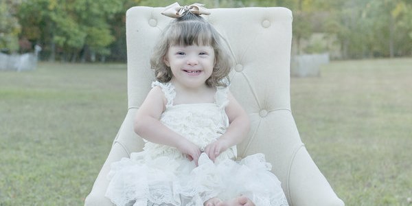 The beauty of children with Down syndrome (PHOTO)