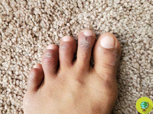 From cracked heel to swelling, what do your feet say about your health?