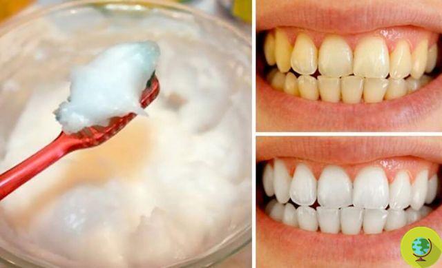 Cómo blanquear los dientes de forma natural, sin dañar el esmalte