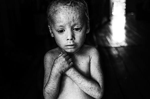 The human cost of GMOs and pesticides in agriculture in the touching photos of Pablo Ernesto Piovano (PHOTO)