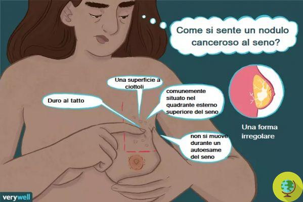 Breast Cancer: Symptoms Everyone Should Know
