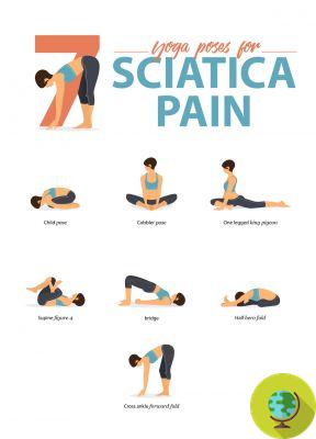 Sciatica: Exercises and natural remedies for inflammation of the sciatic nerve