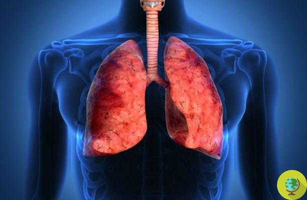 Cómo proteger los pulmones de la contaminación del aire: 10 remedios y consejos