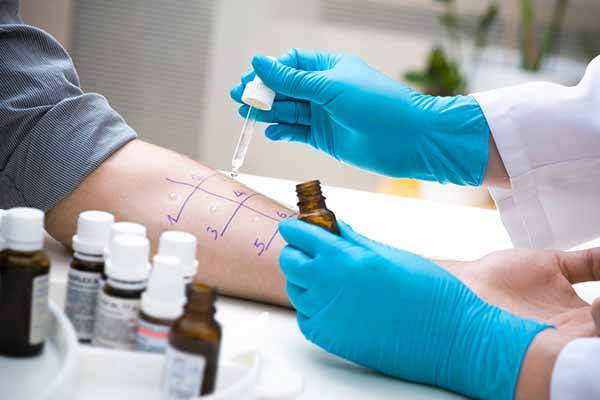 Prick Test: how it works, when and how to do the allergy test