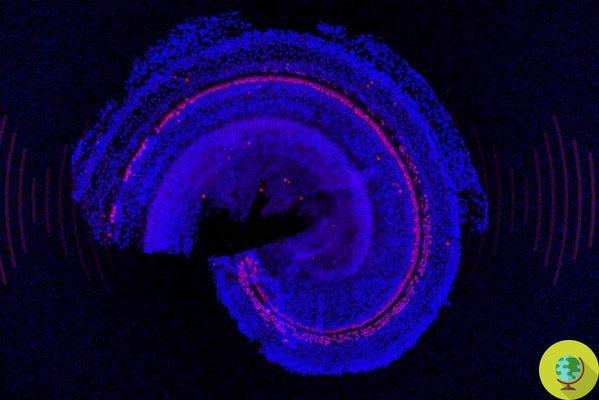 Sensacional descoberta do MIT, perda auditiva pode ser recuperada regenerando as células ciliadas do ouvido