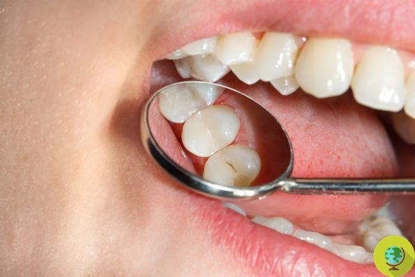 Cárie dentária - um inimigo silencioso que pode causar doenças graves no coração e em outros órgãos