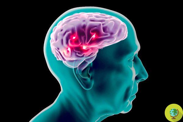 Alzheimer : si vous souffrez d'herpès, vous êtes peut-être plus susceptible de souffrir de ces maladies neurodégénératives