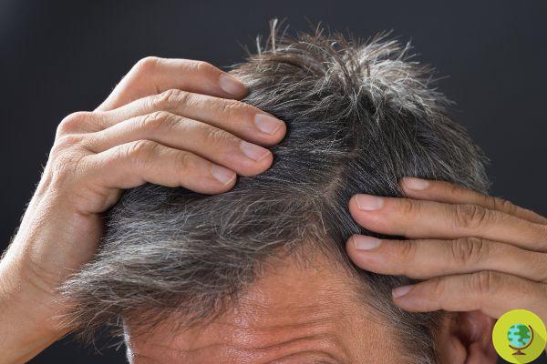 Gray hair can return to its original color, science says