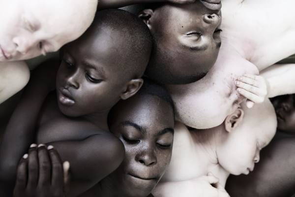 Las maravillosas tomas para denunciar la masacre silenciosa de niños albinos africanos