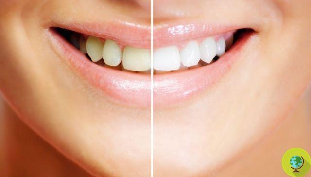 10 remédios naturais para clarear os dentes