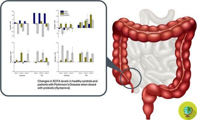 Suplementos probióticos podem reduzir os sintomas de inflamação intestinal em pacientes com Parkinson. eu estudo