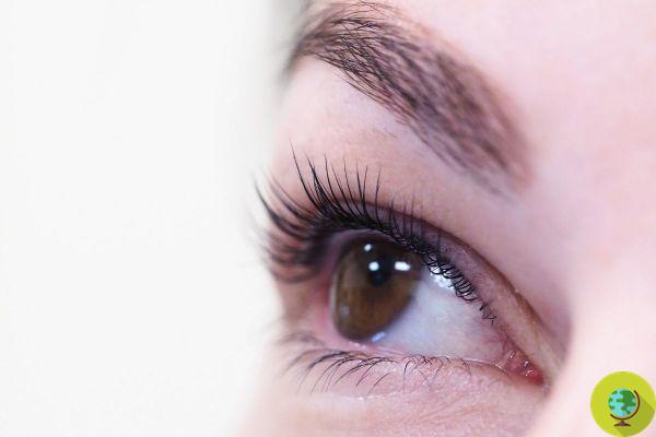Do you know that your eyelashes are vulnerable to lice infestation? How to recognize and treat them