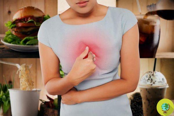 Gastroesophageal reflux, the causes that trigger it. Attention also to sport