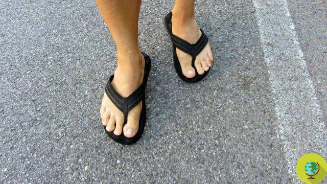 Flip flops: 10 reasons not to use them according to American podiatrists