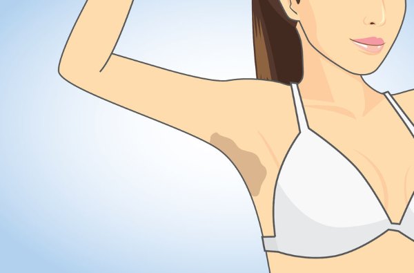 Hair removal: how to remove hair at no cost (and naturally)
